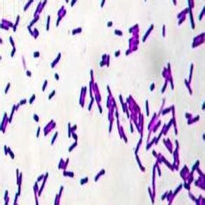 Gram stain and clear zone of Bacillus subtilis sp. B1. | Download ...