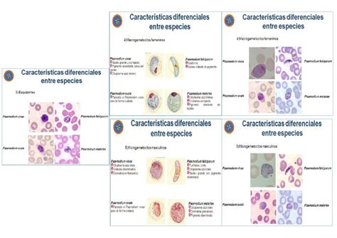 Imagenes De Plasmodium Mariangelys Castillo Udocz