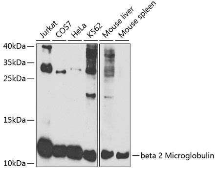 beta 2 Microglobulin Polyclonal Antibody | EpigenTek