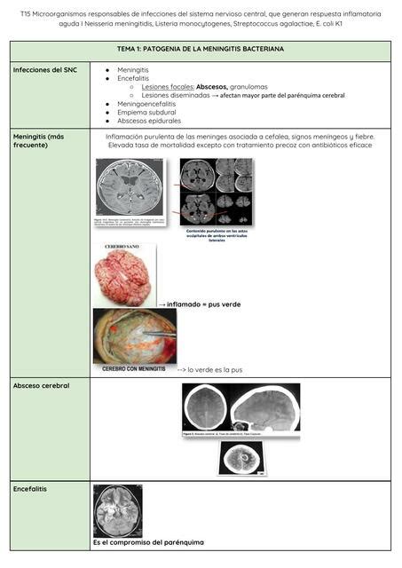 Patogenia De La Meningitis Bacteriana Alyssa Baigorria Udocz