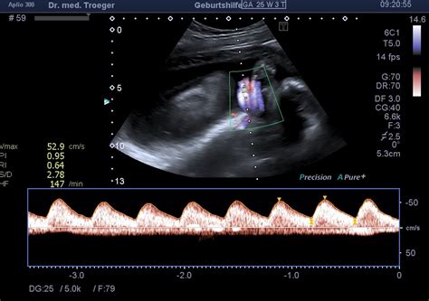 Ultraschalluntersuchungen In Der Schwangerschaft Frauenarztpraxis Rostock