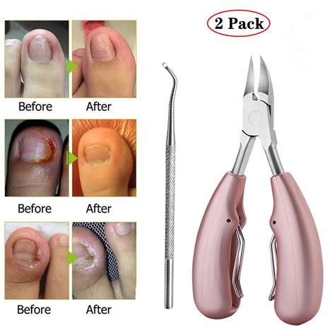 Amerteer Toenail Clippers For Thick Fungal Or Ingrown Toenails Large