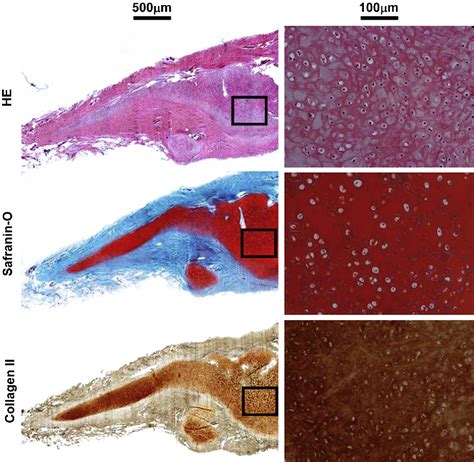 Figure 1 From Regeneration Of Human Ear Shaped Cartilage By Co