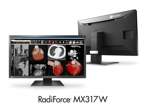 Monitor Medyczny Eizo Radiforce Mx W Wyswietlanie Pl