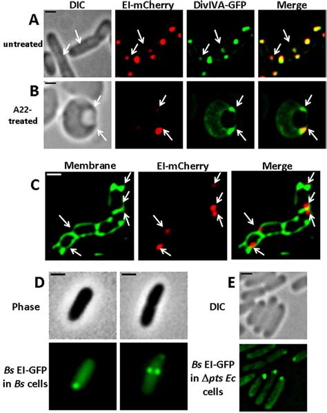 The E Coli EI Protein And The B Subtilis DivIVA And EI Proteins Show