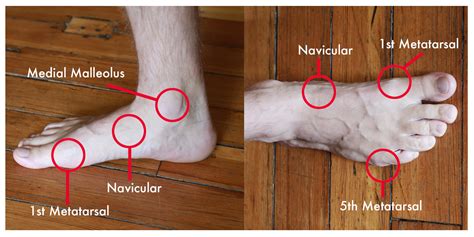 Top Of Foot Hurts When Pressure Put On It Online Emergencydentistry