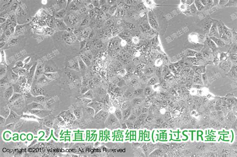 Caco 2 Caco2caco 2atcc 人结直肠腺癌细胞价格品牌whelab 丁香通官网