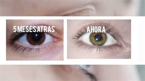 Cambia El Color De Tus Ojos Naturalmente En Meses Mis Resultados