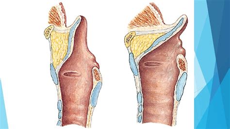 Larynx Larynx Neonate Adult Cartilagines Laryngis Cartilago Thyroidea