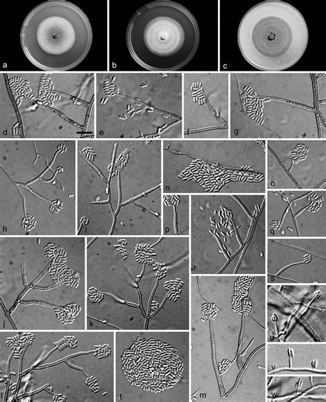 Phaeoacremonium Cinereum Ac Sixteen Day Old Colonies On Mea At 25 C