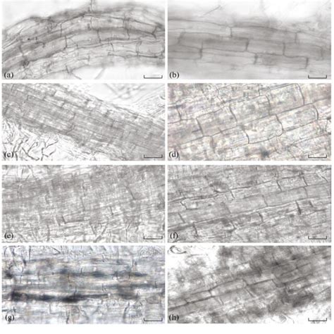 A B Size And Shape Of Wild Type Tobacco Root Cells And Transgenic Download Scientific