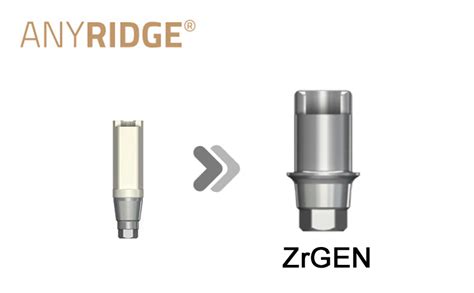 Anyridge Zrgen Ti Base Megagen Digital