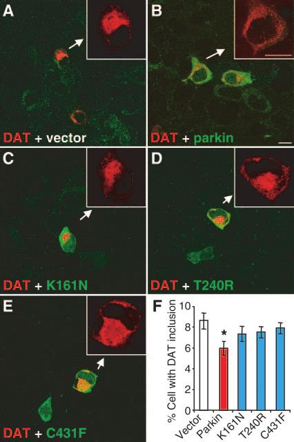 Parkin But Not Its PD Linked Mutants Significantly Decreases The