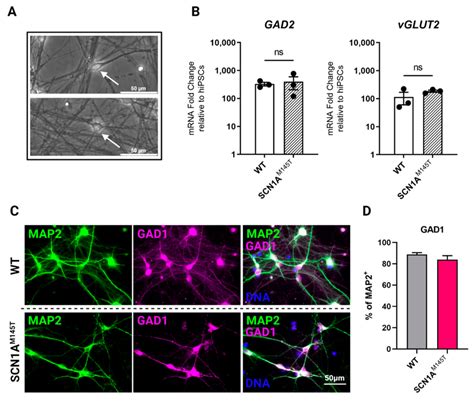 Expression Of Gabaergic And Glutamatergic Markers In Idns A