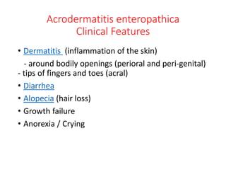 Zinc Deficiency Acrodermatitis Enteropathica