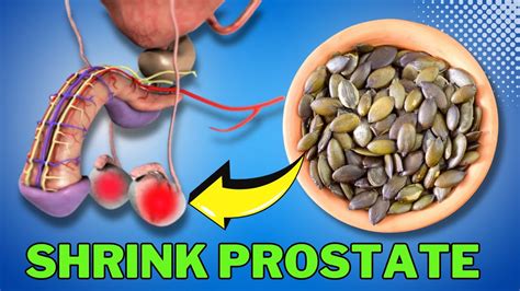 Top 10 Best Foods To Shrink Enlarged Prostate Youtube