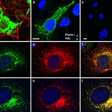 Tpcn Is Localized In The Lysosomes Immunocytochemistry Of Tpcn In