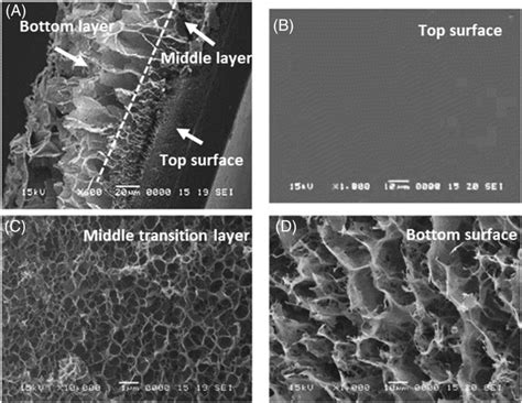 Sem Photographs Of Asymmetric Porous Chitosan Membranes As Reported By