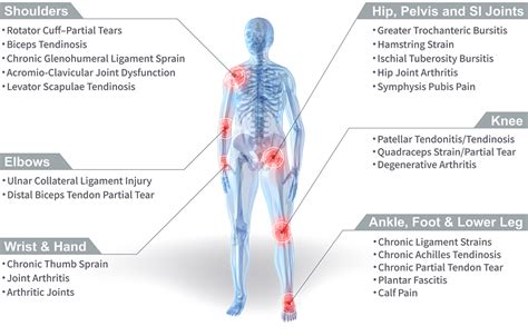 Stem Cell Treatment For Joint Pain Ashmore Osteopathic GroupAshmore