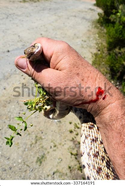 Snake Bite Snakebite Pacific Gopher Snake Stock Photo Edit Now 337164191