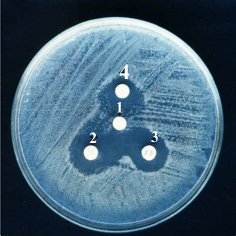 Detection Of Esbl Production In Klebsiella Pneumoniae 6 C By Disk