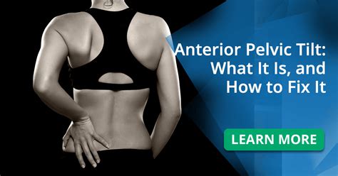 What Is Anterior Pelvic Tilt And How To Fix It What Is Anterior Pelvic Tilt And How To Fix