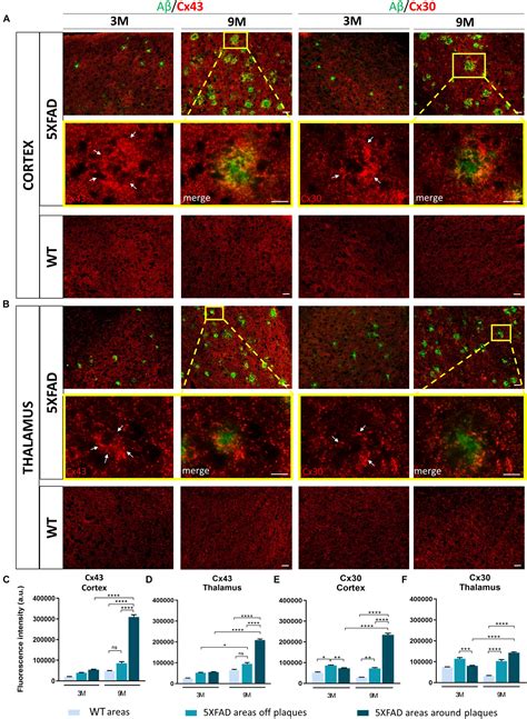 Frontiers Altered Expression Of Glial Gap Junction Proteins Cx43