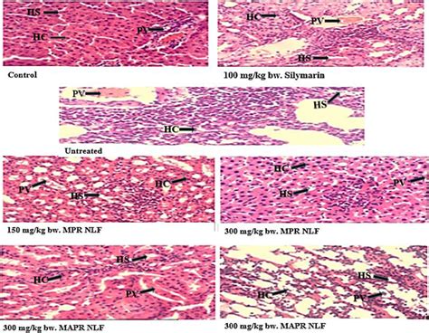 Histology Of The Liver Of Male Wistar Rats Administered With Lead