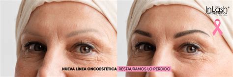 Oncoestética InLash Cejas y Pestañas