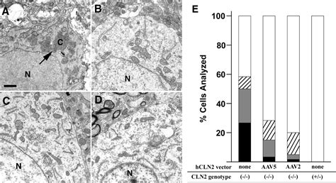 Intracranial Delivery Of Cln2 Reduces Brain Pathology In A Mouse Model