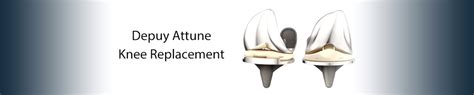 Depuy Attune Knee Replacement, Medical Devices, Practice Areas ...