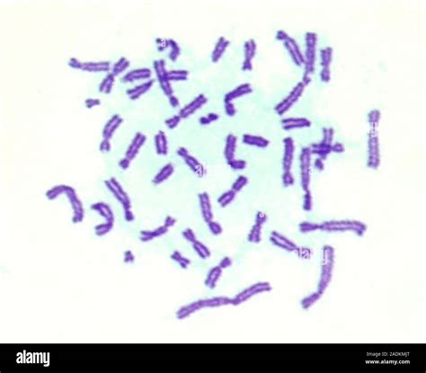 Hamster chromosomes. Light micrograph of normal chromosomes (purple ...