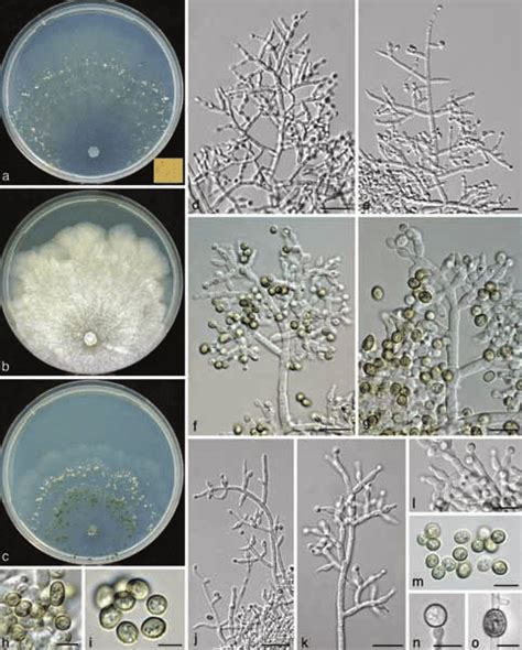 Trichoderma Sempervirentis S599 CBS 133498 A C Cultures After 10