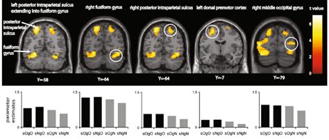 Brain Regions Showing Grasp Object Grasp Nothing Significantly