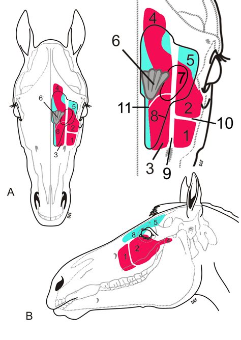 Anatomy Of Sinus Drainage - Anatomy Reading Source