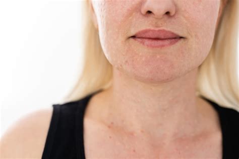 Bio Revitalisation Du Visage Et Du Cou La Lutte Contre Les Signes De L