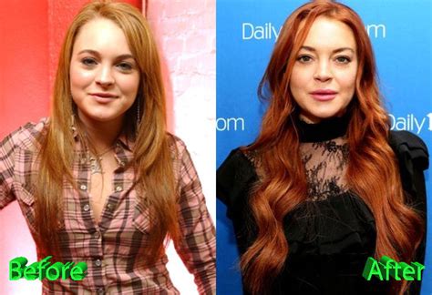 Lindsay Lohan Plastic Surgery Is She Done With It