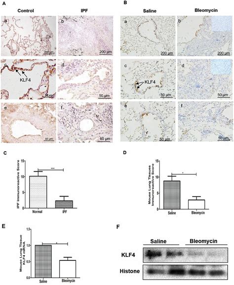 Klf Expression Was Downregulated In Human Ipf Lung Tissues And Mouse