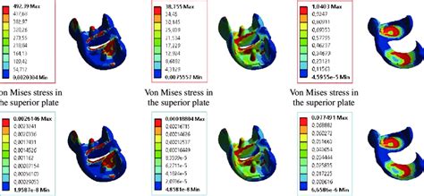 Distribution Of Maximum Von Mises Stresses And Strains In The Implant Download Scientific