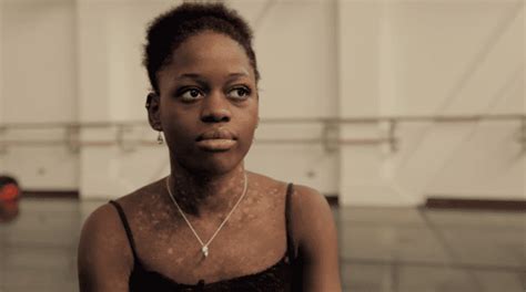 Michaela Deprince Alchetron The Free Social Encyclopedia