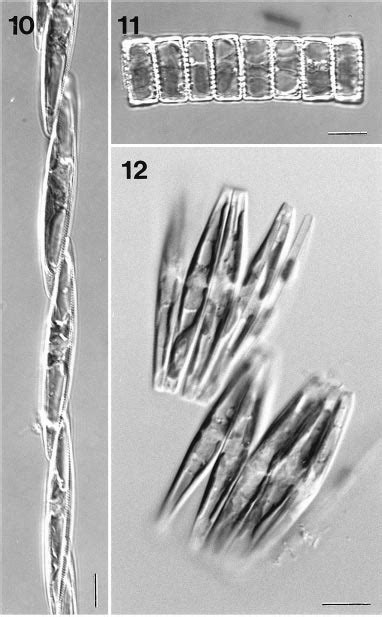 Light Micrographs Fig Pseudo Nitzschia Seriata Stepped Colony In