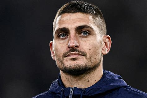 Marco Verratti l ex joueur du PSG blessé au visage lors de son 1er