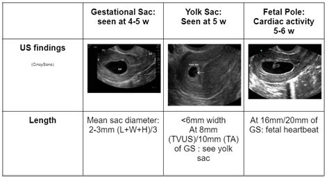 Oh Man Interstitial Ectopic — Kwak Talk