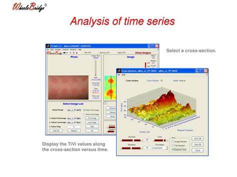 Ppt Tissue Viability Imager Tivi600 Powerpoint Presentation Free