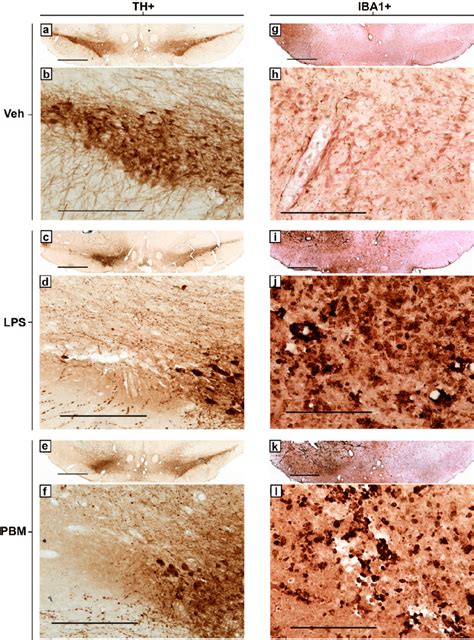 Representative Photomicrographs Of Th And Iba1 Immunostaining In The