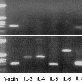 Analysis Of Constitutive And Induced Cytokine Mrna Expression By Ku