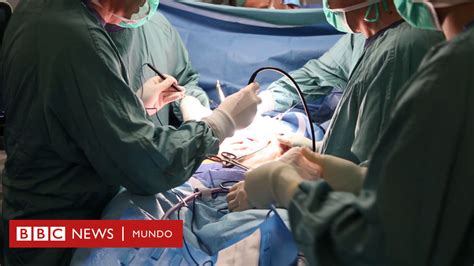 La Pionera Cirugía Para Operar El Cáncer De Páncreas Uno De Los Más