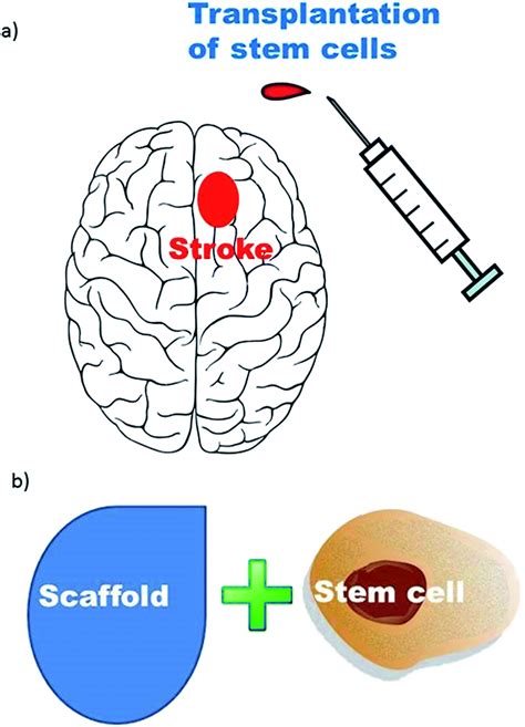 Stem Cell Therapies For Ischemic Stroke Current Animal Models