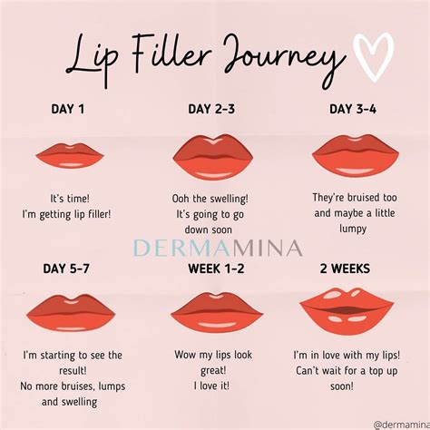 Smile 7 Best Lip Fillers In London Clinics And Prices