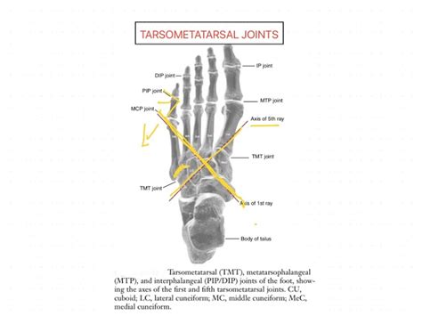 Tarsometatarsal Joint Ligaments